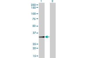 Western Blot analysis of BLVRA expression in transfected 293T cell line by BLVRA monoclonal antibody (M01), clone 4G4-2B6. (Biliverdin Reductase 抗体  (AA 1-296))