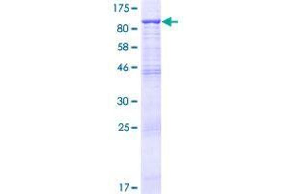 FBXO21 Protein (AA 1-621) (GST tag)