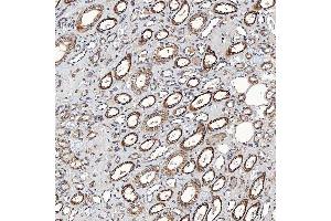 IHC analysis of SETD3 using anti-SETD3 antibody (ABIN7600293).