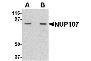 Image no. 1 for anti-Nucleoporin 107kDa (NUP107) (C-Term) antibody (ABIN342686) (NUP107 抗体  (C-Term))