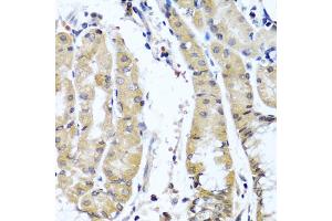 Immunohistochemistry of paraffin-embedded human stomach using COL9A1 antibody. (COL9A1 抗体)