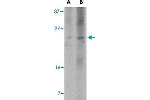 Western blot analysis of BBC3 expression in K-562 cell lysate with BBC3 monoclonal antibody, clone 10C5G1  at (A) 2.