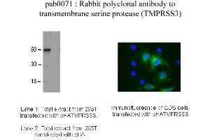 Image no. 1 for anti-Transmembrane Protease, Serine 3 (TMPRSS3) antibody (ABIN347032) (TMPRSS3 抗体)