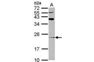 Image no. 1 for anti-ADP-Ribosylation Factor-Like 8A (ARL8A) (AA 1-186) antibody (ABIN1496722) (ARL8A 抗体  (AA 1-186))