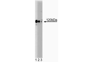 Western blot analysis of PRK1 on Jurkat lysate. (PKN1 抗体  (AA 215-388))