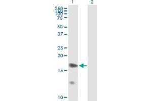 Western Blot analysis of PPP1R7 expression in transfected 293T cell line by PPP1R7 MaxPab polyclonal antibody.