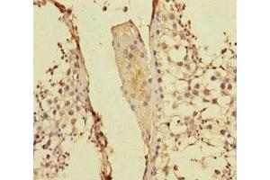 Immunohistochemistry of paraffin-embedded human testis tissue using ABIN7158455 at dilution of 1:100 (PPFIA1 抗体  (AA 660-800))