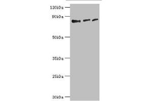 Western blot All lanes: Histone-lysine N-methyltransferase EZH1 antibody at 4 μg/mL Lane 1: Hela whole cell lysate Lane 2: HL60 whole cell lysate Lane 3: Mouse gonad tissue Secondary Goat polyclonal to rabbit IgG at 1/10000 dilution Predicted band size: 86, 87, 81, 77, 69 kDa Observed band size: 86 kDa (EZH1 抗体  (AA 160-280))