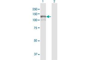 Western Blot analysis of MAN2B1 expression in transfected 293T cell line by MAN2B1 MaxPab polyclonal antibody. (MAN2B1 抗体  (AA 1-1011))