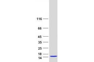 Validation with Western Blot