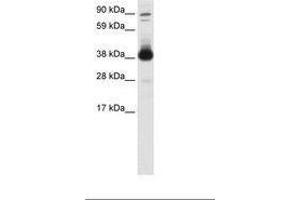Image no. 1 for anti-Forkhead Box H1 (FOXH1) (AA 241-290) antibody (ABIN6736080) (FOXH1 抗体  (AA 241-290))