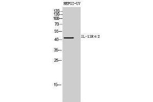 Western Blotting (WB) image for anti-Interleukin 13 Receptor, alpha 2 (IL13RA2) (Internal Region) antibody (ABIN3181455) (IL13RA2 抗体  (Internal Region))