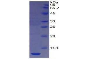 SDS-PAGE of Protein Standard from the Kit  (Highly purified E. (CD31 ELISA 试剂盒)