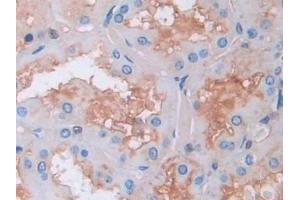Detection of GAB1 in Human Kidney Tissue using Polyclonal Antibody to GRB2 Associated Binding Protein 1 (GAB1) (GAB1 抗体  (AA 394-656))