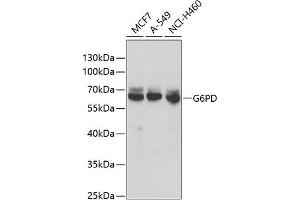 Western blot analysis of extracts of various cell lines, using G6PD antibody (ABIN6131014, ABIN6140863, ABIN6140864 and ABIN6218178) at 1:1000 dilution. (Glucose-6-Phosphate Dehydrogenase 抗体  (AA 246-545))