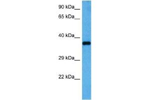 Host:  Rabbit  Target Name:  GAPDH  Sample Tissue:  Mouse Heart  Antibody Dilution:  1ug/ml (GAPDH 抗体  (Middle Region))