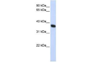 ZNF364 antibody used at 1 ug/ml to detect target protein. (RNF115 抗体  (C-Term))