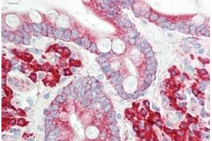 Human Small Intestine: Formalin-Fixed, Paraffin-Embedded (FFPE) (ETFA 抗体  (AA 276-304))