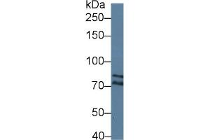 Western Blotting (WB) image for anti-Dicer 1, Ribonuclease Type III (DICER1) (AA 6-290) antibody (ABIN7436789)