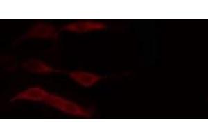 ABIN6274383 staining HuvEc cells by IF/ICC. (DGKD 抗体  (N-Term))