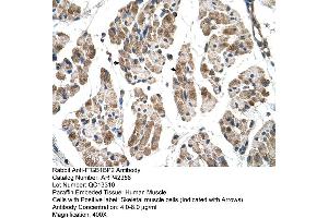 Rabbit Anti-ITGB1BP2 Antibody  Paraffin Embedded Tissue: Human Muscle Cellular Data: Skeletal muscle cells Antibody Concentration: 4. (ITGB1BP2 抗体  (N-Term))