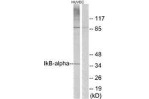 Western blot analysis of extracts from HuvEc cells, treated with TNF-alpha 20ng/ml 30', using IkappaB-alpha (Ab-42) Antibody. (NFKBIA 抗体  (AA 9-58))