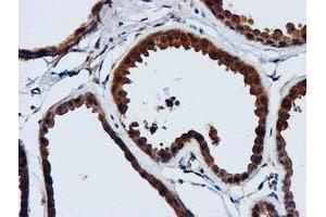 Immunohistochemical staining of paraffin-embedded Human breast tissue using anti-GATM mouse monoclonal antibody. (GATM 抗体)