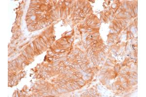 ABIN6383845 to B2M was successfully used to stain carcinoma in human lung, cervex and colon sections.