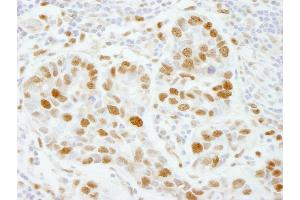 Immunohistochemistry (IHC) image for anti-Polymerase (DNA Directed), epsilon 3 (p17 Subunit) (POLE3) (AA 97-147) antibody (ABIN7448733)