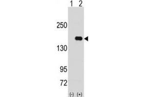 Western Blotting (WB) image for anti-Pumilio Homolog 2 (Drosophila) (PUM2) antibody (ABIN3003295)