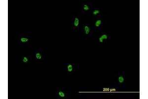 Image no. 2 for anti-CSE1 Chromosome Segregation 1-Like (CSE1L) (AA 872-972) antibody (ABIN465994) (Exportin 2 抗体  (AA 872-972))