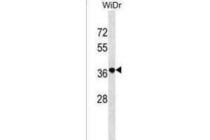 RN3L1 Antibody (C-term) (ABIN1537047 and ABIN2838093) western blot analysis in WiDr cell line lysates (35 μg/lane). (RN3L1 (AA 286-312), (C-Term) 抗体)