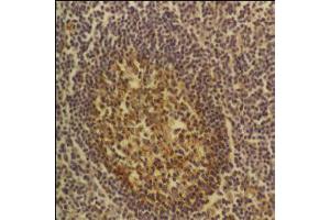 CD54 – ABIN118785 - Tonsil. (ICAM1 抗体)