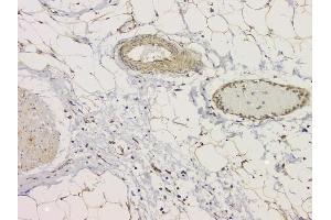 IHC analysis of SRCIN1 using anti-SRCIN1 antibody (ABIN6719623).