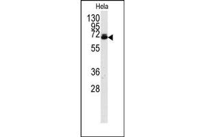 Image no. 1 for anti-Ubiquilin 2 (UBQLN2) (AA 28-57), (N-Term) antibody (ABIN357609) (Ubiquilin 2 抗体  (N-Term))