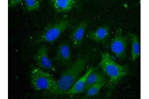 Detection of CRYaB in Human U2OS Cell using Polyclonal Antibody to Crystallin Alpha B (CRYaB) (CRYAB 抗体  (AA 1-175))