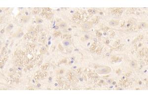 Detection of PMP22 in Mouse Spinal cord Tissue using Polyclonal Antibody to Peripheral Myelin Protein 22 (PMP22)