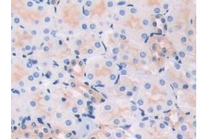Detection of MYL3 in Mouse Kidney Tissue using Polyclonal Antibody to Myosin Light Chain 3, Alkali, Ventricular, Slow Skeletal (MYL3) (MYL3/CMLC1 抗体  (AA 8-199))