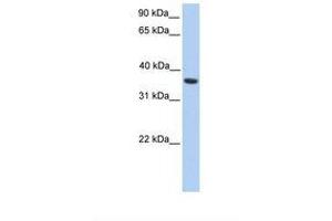 Image no. 1 for anti-Melanoma Antigen Family A, 4 (MAGEA4) (C-Term) antibody (ABIN6738943) (MAGEA4 抗体  (C-Term))