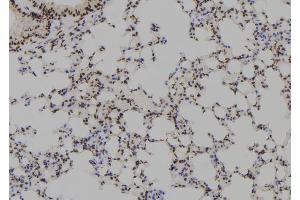 ABIN6279488 at 1/100 staining Mouse lung tissue by IHC-P. (HOXB1 抗体  (Internal Region))