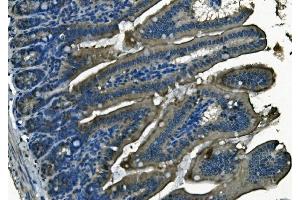 IHC analysis of PI-16/PI16 using anti-PI-16/PI16 antibody (ABIN7601074).