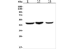 Western blot analysis of Ccr2 using anti-Ccr2 antibody (ABIN7602745).