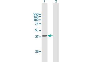 Western Blot analysis of HSD3B1 expression in transfected 293T cell line by HSD3B1 MaxPab polyclonal antibody. (HSD3B1 抗体  (AA 1-373))