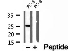 Western blot analysis of extracts of PC-3 cells, using OIP5 antibody. (OIP5 抗体  (C-Term))