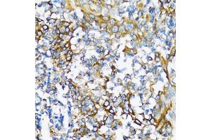 Immunohistochemistry of paraffin-embedded human tonsil using NFKB1 antibody (ABIN5998332) at dilution of 1/100 (40x lens). (NFKB1 抗体)
