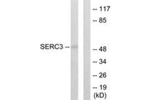 Western Blotting (WB) image for anti-Serine Incorporator 3 (SERINC3) (AA 361-410) antibody (ABIN2889579) (SERINC3 抗体  (AA 361-410))
