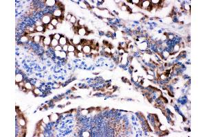 Anti-HSD17B2 antibody,  IHC(P) IHC(P): Rat Intestine Tissue (HSD17B2 抗体  (C-Term))