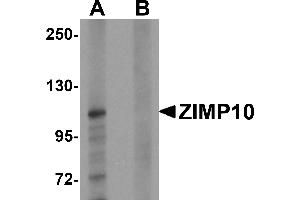 Western blot analysis of ZIMP10 in K562 cell lysate with ZIMP10 antibody at 0. (ZMIZ1 抗体  (N-Term))
