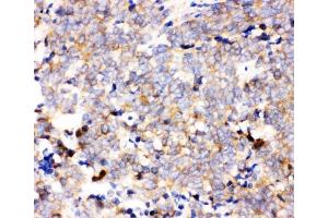 IHC analysis of IKKA using anti-IKKA antibody (ABIN3043812). (IKK alpha 抗体  (AA 411-745))