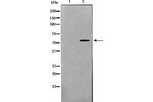 Western blot analysis on HeLa cell lysate using GK2 Antibody，The lane on the left is treated with the antigen-specific peptide. (GK2 抗体  (Internal Region))